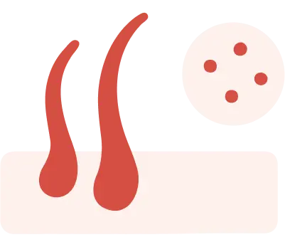 Icon 髮量異常