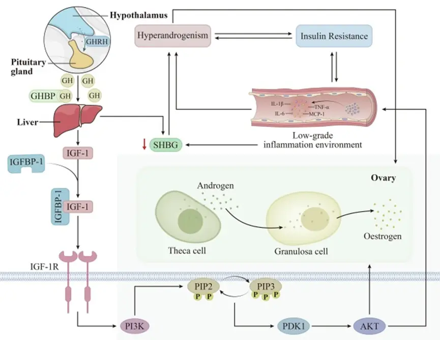 When IGF-1 Meets Metabolic Inflammation and Polycystic Ovary Syndrome