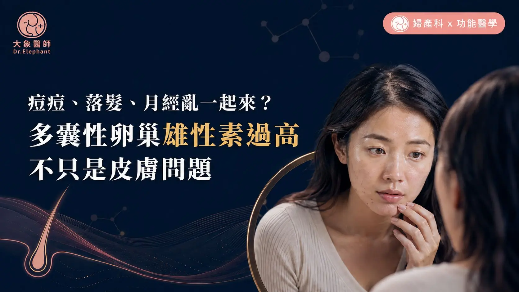 痘痘、落髮、月經亂一起來？多囊性卵巢雄性素過高，不只是皮膚問題